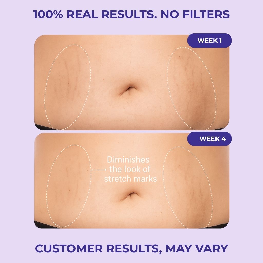Tighten & Smooth Belly Cream